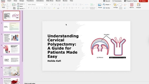 Thumbnail for Cervical Polyectomy 