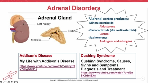 Thumbnail for Unit 14 Recorded Lecture Addison's/Cushing's
