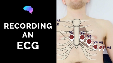 Thumbnail for entry HTHS 2231Cardiovascular: Recording An ECG Video with Questions