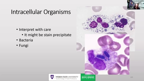 Thumbnail for entry Intracellular Organisms and Inherited Functional Abnormalities of Neutrophils