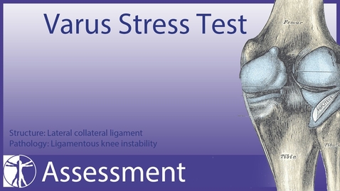Thumbnail for Varus Stress Test | Lateral Collateral Ligament