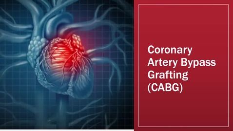 Thumbnail for CABG.mp4