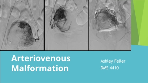 Thumbnail for Kaltura Capture recording - February 9th 2022, 7:38:15 pm