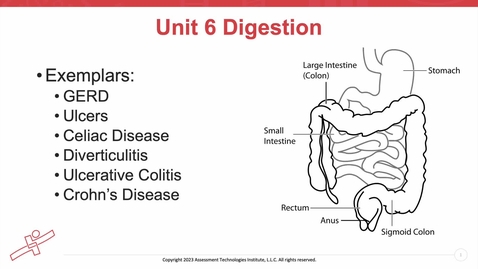 Thumbnail for Unit 6 Recorded Lecture Part 1 GERD, Peptic Ulcer Disease