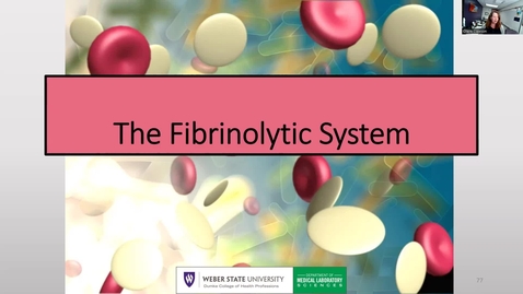 Thumbnail for Unit 5 Lecture 3 Fibrinolytic System, Specimen Requirements, and Primary Hemostasis Testing New