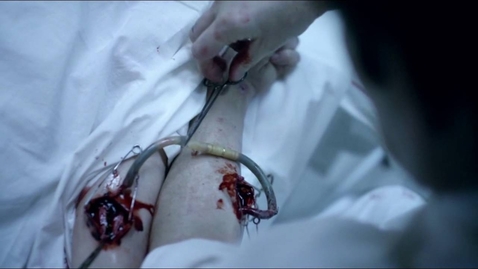 Thumbnail for blood transfusion - Quiz