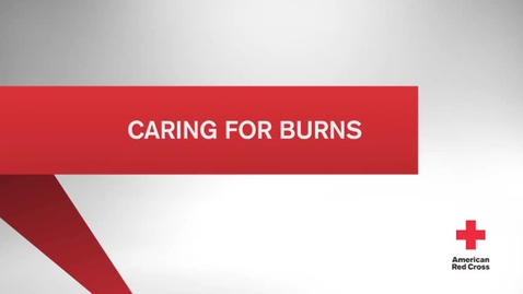 Thumbnail for 29 Caring for Burns.mp4 - Quiz