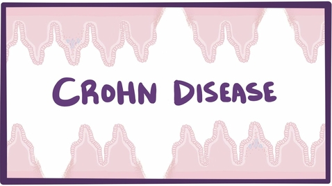 Thumbnail for entry HTHS 2230 Digestive: Crohn's disease (Crohn disease) Video with Questions