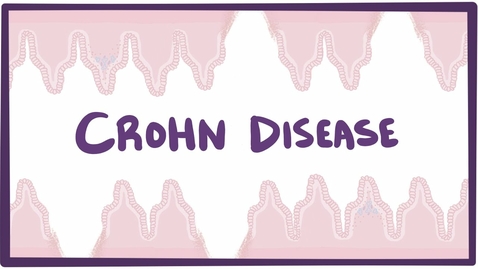 Thumbnail for HTHS 2230 Digestive: Crohn's disease (Crohn disease) Video with Questions