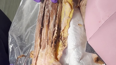 Thumbnail for Antebrachial Flexor mm.