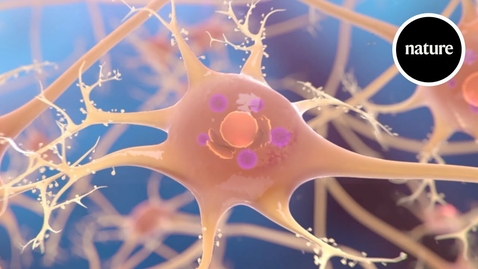 Thumbnail for HTHS 1101 F06-03 Parkinson Disease Video with Questions