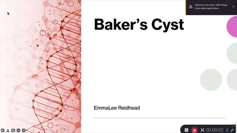 Thumbnail for entry DMS Case Study 2 Baker's Cyst