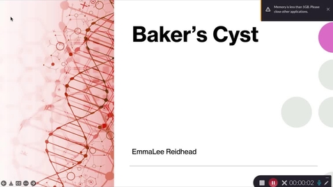 Thumbnail for DMS Case Study 2 Baker's Cyst