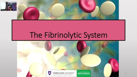 Thumbnail for Coagulation-The Fibrinolytic System