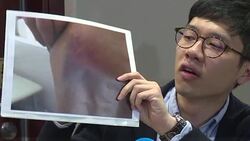 CLEAN : Pro-democracy Hong Kong lawmaker condemns 'violent attacks' News Clip