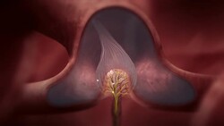 A computer-generated anatomical model of a Tyrannosaurus Rex features its visual system. Stock Footage