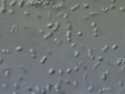 Friendly bacteria, Lactobacillus casei. A rod-shaped gram-positive, non-sporing, non-motile, obligate anaerobe, which inhabits human intestinal tracts. It is beneficial to human health eg improves and promotes digestion. Stock Footage