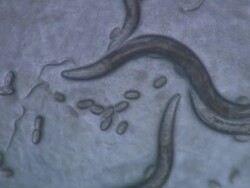 Adult Caenorhabditis elegans nematode with eggs Stock Footage