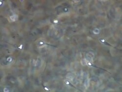 Human sperm swimming, Phase contrast Stock Footage