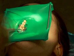 Dentist and assistant making dental filling Stock Footage