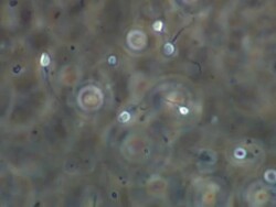 Single Human sperm swimming, noisy background, Phase contrast Stock Footage