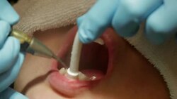 Healthcare Dental Cleaning Service at Clinic Stock Footage