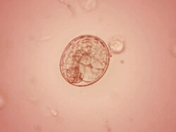 Embryo in the egg Stock Footage