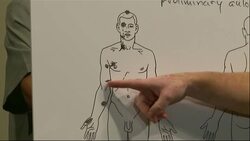 Forensic pathologists and family attorney for an unarmed black teenager fatally shot by police in Missouri says a private autopsy confirms witness accounts that Michael Brown was shot multiple times. (Aug. 18) News Clip