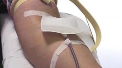 CLEAN : Nice: local medical services overwhelmed with blood donors News Clip