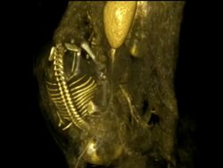 CGI of a three-dimensional reconstruction of a CT scan of a woman pregnant with a 31 week fetus Stock Footage