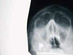Dentist examining X-Ray image Stock Footage