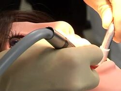 CLEAN: Japan unveils always-willing dental patient - a robot News Clip