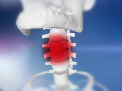 HD: Human Skeleton With A Sore Throat Stock Footage