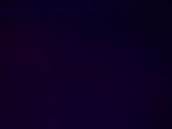 HD Disco Laser Close-up (Loopable) Stock Footage