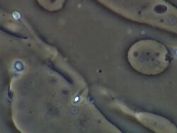 Human sperm, single sperm swimming, a few others around Stock Footage