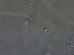 Single Human sperm swimming, Interference contrast Stock Footage