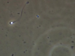 Single Human sperm swimming, better, Phase contrast Stock Footage