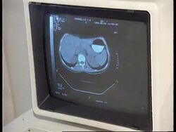 Russia-Stabbing of Olympic swimming champion Popov News Clip