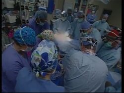 Hospital presser on a separation operation News Clip