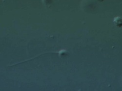Single Human sperm swimming, Interference contrast Stock Footage