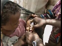 SOMALIA: BUR-AKABA: UN - POLO VACCINATION PLAN News Clip