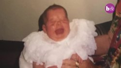 The Woman Who’s Allergic To Daylight | BORN DIFFERENT Instructional Video