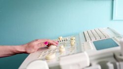 Hands of doctor working at the ultrasound device,Echocardiography Stock Footage