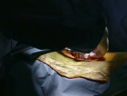 MS Surgery assistant helping surgeon / Cagliari, Sardinia, Italy Stock Footage