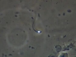 Human sperm, swimming Stock Footage