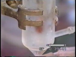 South Africa - Breakthrough in medical research News Clip