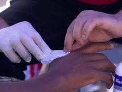 Young Man Having Injured Tended To News Clip