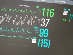 Heart Monitor Stock Footage