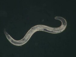 Caenorhabditis elegans Stock Footage