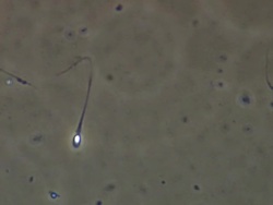 Single Human sperm swimming, Phase contrast Stock Footage